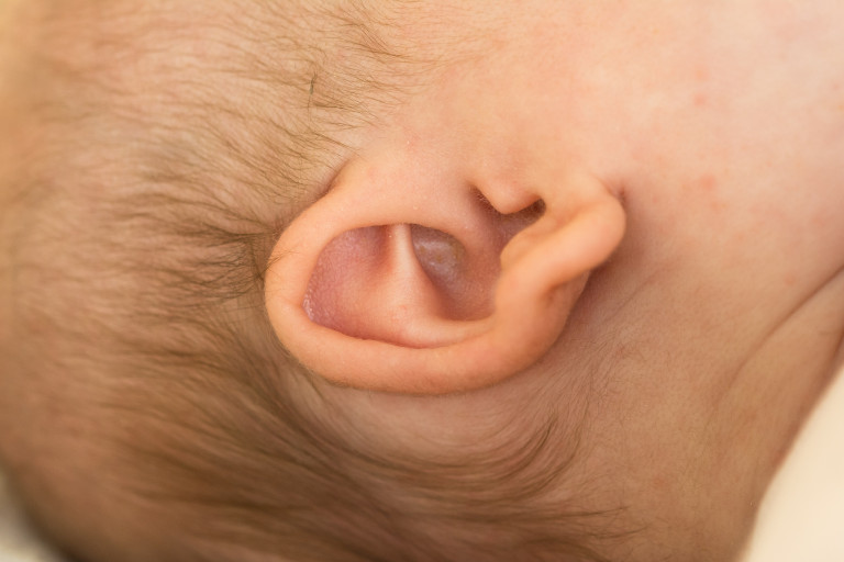 dépistage auditif nouveau-né